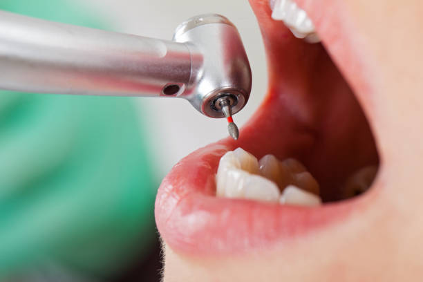 Best Walk-In Emergency Dentist in Foley, MN